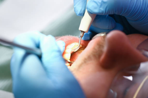 Best Walk-In Emergency Dentist in Evans, GA