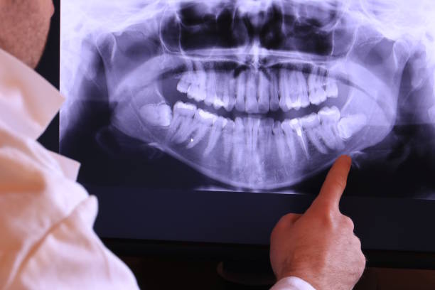 Best Emergency Treatment for Toothache in Evans, GA