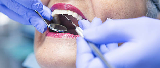 Best Emergency Tooth Extraction in Evans, GA